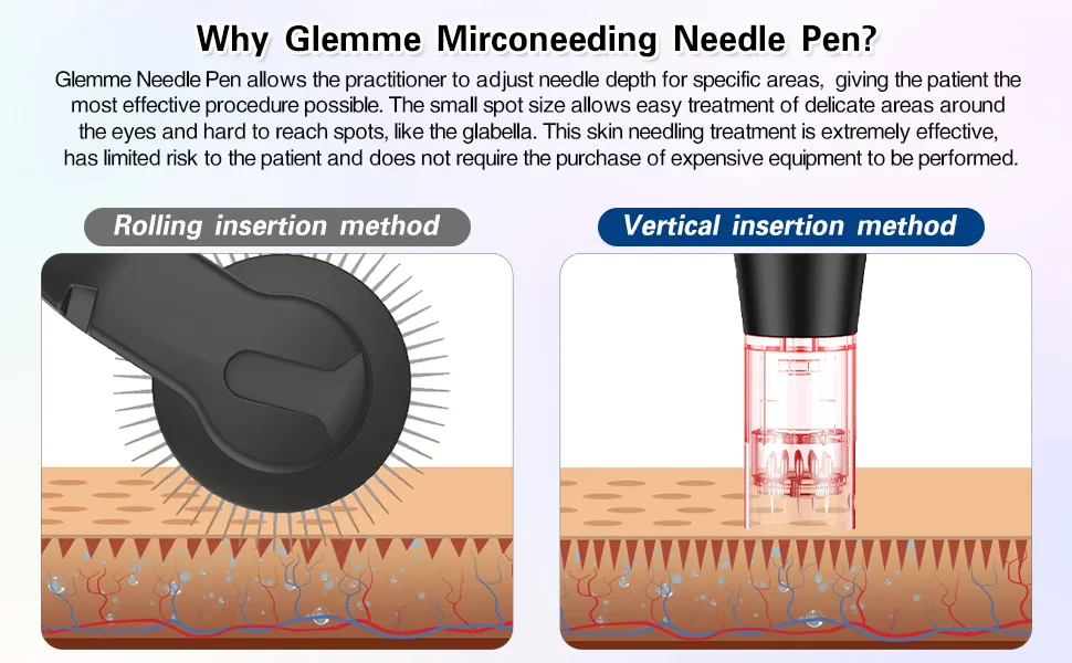 Microneedling Pen Electric Dermapen Professional Adjustable Microneedle with 24PCS Replacement Cartridges, Derma Pen for Face Body - Why Glemme microneeding pen