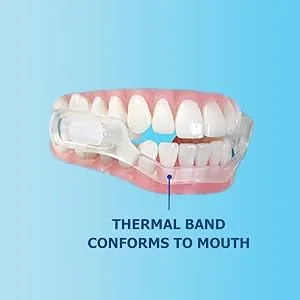 SleepRight® Select-Comfort Dental Guard (New Version) - Sleeping Teeth Guard – Mouth Guard to Prevent Teeth Grinding - SleepRight, Secure, Comfort, Dental, Guard, Teeth, Sleep, Health