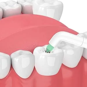 Interdental Replacement Toothbrush Heads for Philips Sonicare Click-on Brush Head System, for Cleaning Braces/Between Teeth/Back Teeth (4-Pack, White) - Cleaning Back Teeth