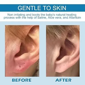 Piercing beading solution natural and gentle solution for ear hole stinging-nose piercing cleaners reduces the risk and quick healing in ear piercing and eyebrow piercings frifer - Einfache Anwendung