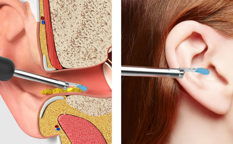 perfk Ear Plugs Visual Accessories Replacement Tools for Ear Wax Removal for New Version Kids - product information 6
