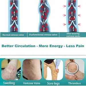 Compression stockings thigh -high compression socks white hose compression stockings prevent leg edema from breathable compression stockings for varicose veins swelling edema (XL) - product information 2