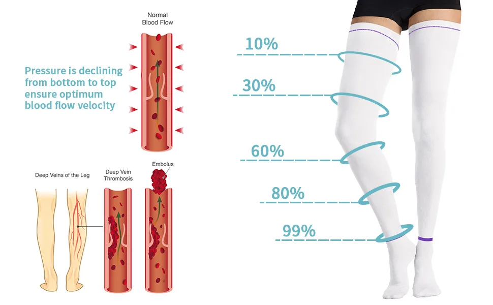 Compression stockings thigh -high compression socks white hose compression stockings prevent leg edema from breathable compression stockings for varicose veins swelling edema (XL) - product information 9