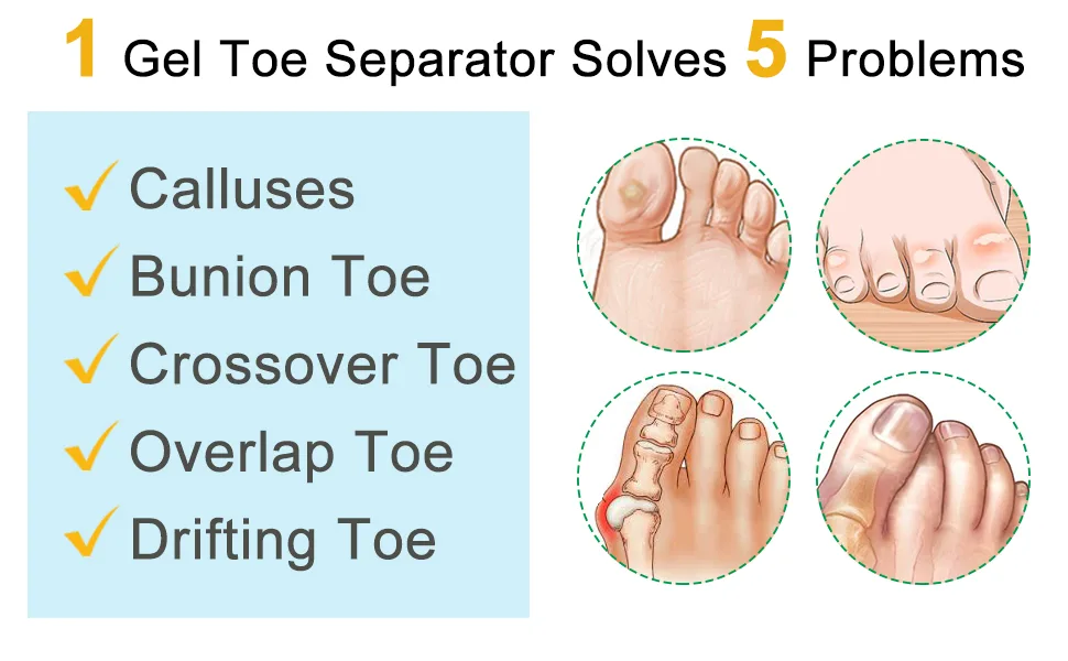 Welnove Pack of 12 Bunion Corrector, Toe Separators with 2 Loops, Big Toe Spacer Suitable for Bunion and Overlap Toe (White) - product information 2