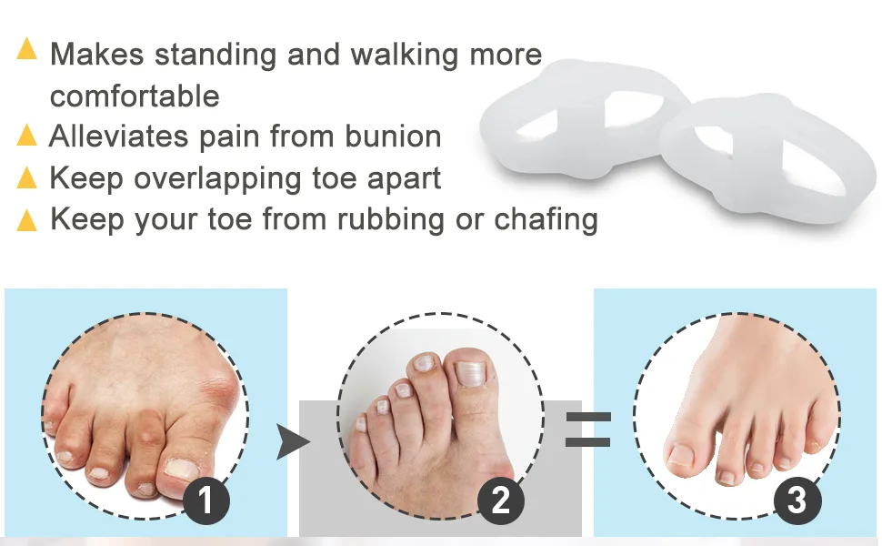 Welnove Pack of 12 Bunion Corrector, Toe Separators with 2 Loops, Big Toe Spacer Suitable for Bunion and Overlap Toe (White) - product information 3