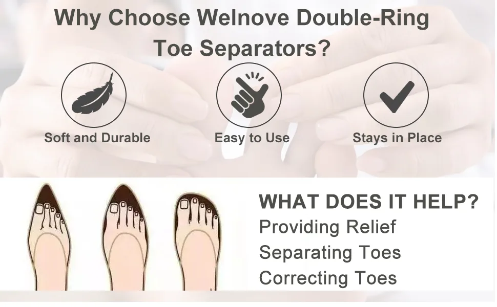 Welnove Pack of 12 Bunion Corrector, Toe Separators with 2 Loops, Big Toe Spacer Suitable for Bunion and Overlap Toe (White) - product information 4