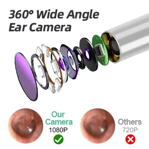 Earwax Removal Tool with Camera,Earwax Cleaner Tools with 1080P FHD Wireless Ear Otoscope,Earwax Cleaner Pick Kit for Android,iPhone & iPad - HD camera