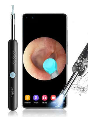 Earwax Removal Tool with Camera,Earwax Cleaner Tools with 1080P FHD Wireless Ear Otoscope,Earwax Cleaner Pick Kit for Android,iPhone & iPad - product information 3