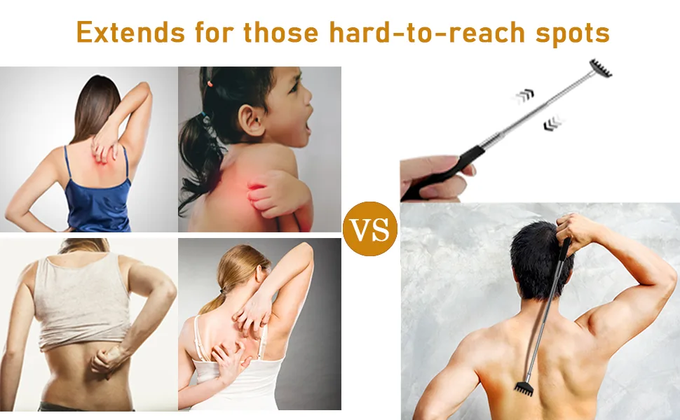 Yexixsr 3 Pack Extendable Back Scratcher Portable Telescopic Back Massager Back Scratchers for Men Women Kids Adults, Back Scratching Tool with Rubber Handles - Before & After