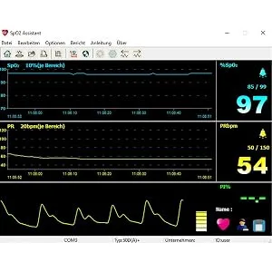 Pulox PO-300 pulse oximeter with color display and alarm including software for long-term recording - Software Bild