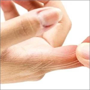 Boxer Finger Splint – Padded Support Brace with Removable Splint for Boxer’s Fracture – Little and Ring Finger Protection – Fits Left or Right Hand (Medium) Medium (Pack of 1) - bottom-e