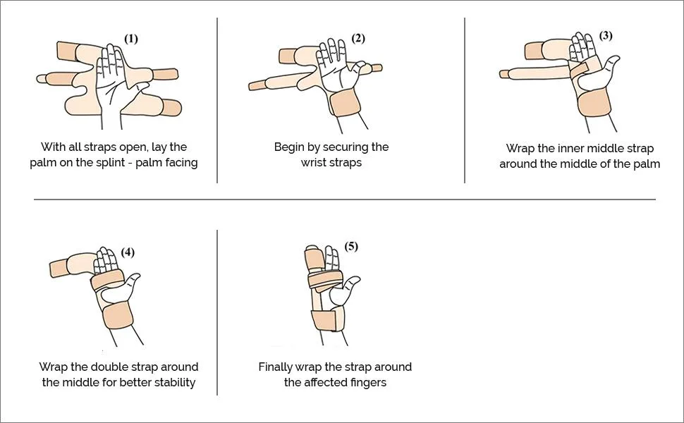 Boxer Finger Splint – Padded Support Brace with Removable Splint for Boxer’s Fracture – Little and Ring Finger Protection – Fits Left or Right Hand (Medium) Medium (Pack of 1) - slide-3
