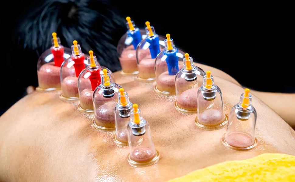24 Cupping Set,Chinese Professional Cupping Therapy Set - 24 Cupping Set,Chinese Professional Cupping Therapy Set