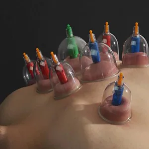 24 Cupping Set,Chinese Professional Cupping Therapy Set - 24 Cupping Set,Chinese Professional Cupping Therapy Set