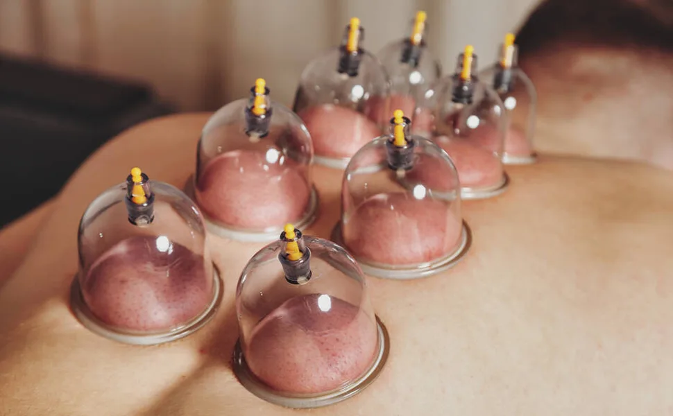 24 Cupping Set,Chinese Professional Cupping Therapy Set - 24 Cupping Set,Chinese Professional Cupping Therapy Set