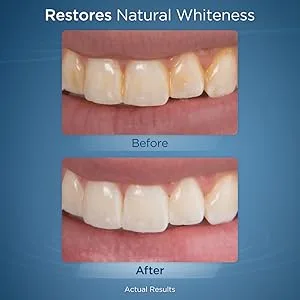 Whitening Water Flosser Refill Tablets (30 Count) - Only for the Whitening Flosser Packaging May Vary - whiten teeth whitening brighter
