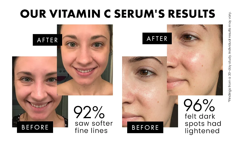 Vitamin C Serum for FaceNeckEyes - 5X MORE POWERFUL Anti-Aging Serum with 20 Vit C - Reduces WrinklesLinesAging - 100 VeganDermatologist Developed - Eclat - Vitamin C Serum