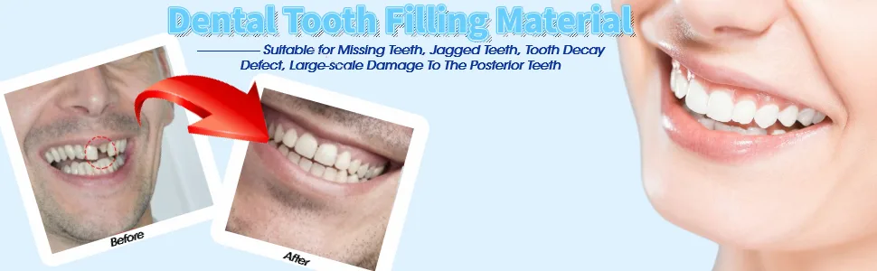 Tooth Repair Kit Temporary Tooth Repair Kit Temporary Tooth Repair Beads for Missing Broken Teeth Dental Tooth Filling Material(100g) - product information 5
