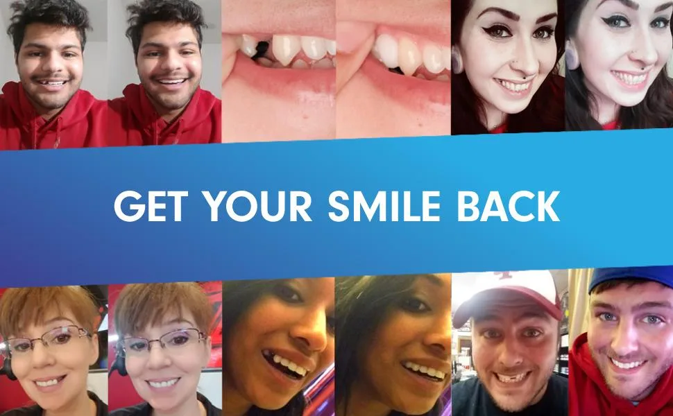 Temptooth 1 Seller Trusted Patented Temporary Tooth Replacement Product - TempTooth Before and After