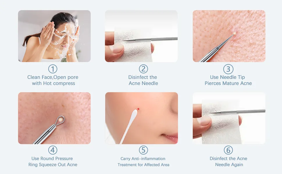 TAYTHI Blackhead Remover Tool Pimple Popper Tool Kit Blackhead Extractor tool for Face Extractor Tool for Comedone Zit Acne Whitehead Blemish Stainless Steel Extraction tools Silver - blackhead pore remover tool