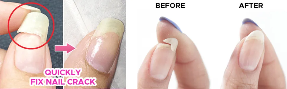 Tachibelle Professional Nail Repair Kit for Broken Cracked Split Nails. Emergency Easy Quick Fix - we123