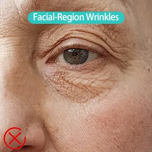 Red Light Therapy for Face Floverkity LED Face Massager RED Light Device at-Home Face Tool for Skin Care - Facial Light Therapy Devices face led light therapy red light therapy for face