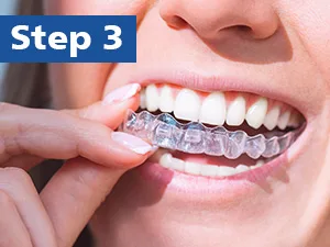 Mouth Guard for Grinding Teeth at Night Moldable Anti Clenching Teeth Mouthguards for Sleep 2 Sizes-Thin Small Dental Guard for Kids with 24 Cleaner Tablets - Easy steps