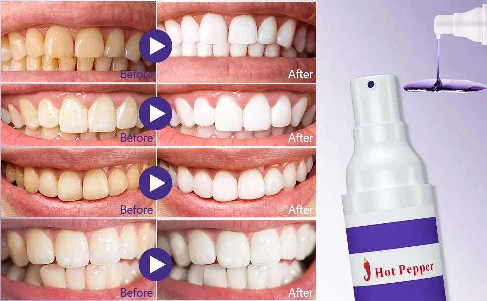 Hot Pepper Natural Purple Toothpaste for Teeth Whitening Color Corrector Purple Toothpaste Brighten Your Smile Gently 30ml - purple toothpaste