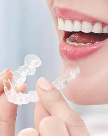 Dental Night Guard Retainers for Teeth Stability | at Home Kit for Perfect Fit Great for Replacement Retainers 1 Units for Upper and Lower Teeth - 2 Guards - Mouth Guard