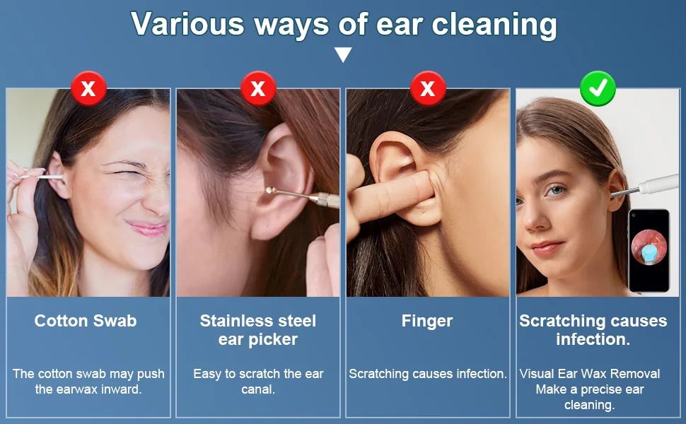 Ear Wax Removal Tool Ear Pick with 1080P HD Camera Earwax Cleaning Kit with 12 Replacement Tips Upgraded Ear Massage Mode and LED Light Wireless Otoscope Ear Camera for iOS & Android (White) - ear camera