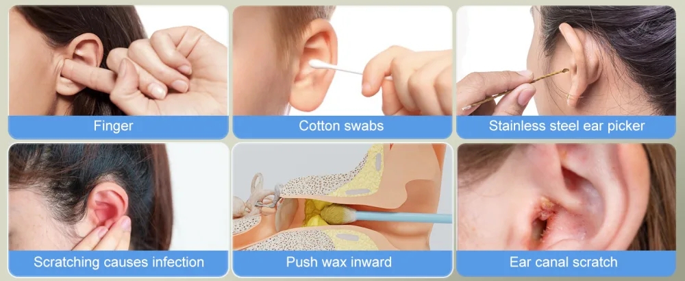 Electric Ear Wax Removal System Water Powered Ear Cleaning Tool with Irrigation Flusher 6 Tips 4 Pressure Settings - Safe & Effective for Ear Wax Buildup Flushing and Cleaning Dark Black - ear wax removal tool