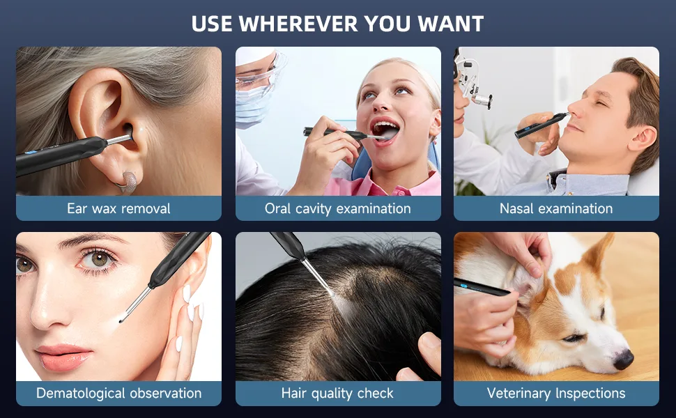 Ear Wax Removal WeGuard Ear Cleaner with Upgraded 1440p Camera Ear Wax Removal Kit Ear Camera Otoscope with Light Ear Cleaning Kit for iPhone iPad Android Phones (Black) - product information 11