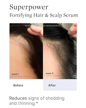 Better Not Younger New Dawn Activated Charcoal Scalp Cleanser 5 Fl Oz - before and after