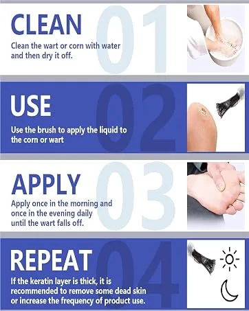 Wart Remover Liquid - Maximum Strength Formula for Rapidly Removing Plantar Warts and Common Warts Safe Natural & Potent Suitable for Most Body Warts - plantar wart remover