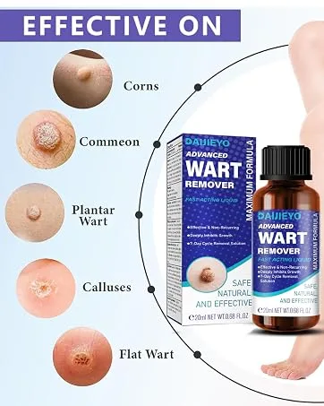 Wart Remover Liquid - Maximum Strength Formula for Rapidly Removing Plantar Warts and Common Warts Safe Natural & Potent Suitable for Most Body Warts - plantar wart remover for feet