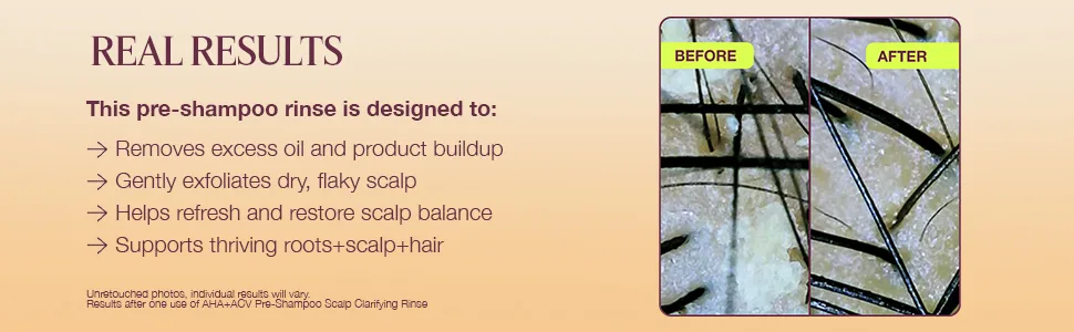 Pre-Shampoo Clarifying Scalp Treatment with AHA + Apple Cider Vinegar 4oz - ACV Pre shampoo helps refresh and restore scalp balance