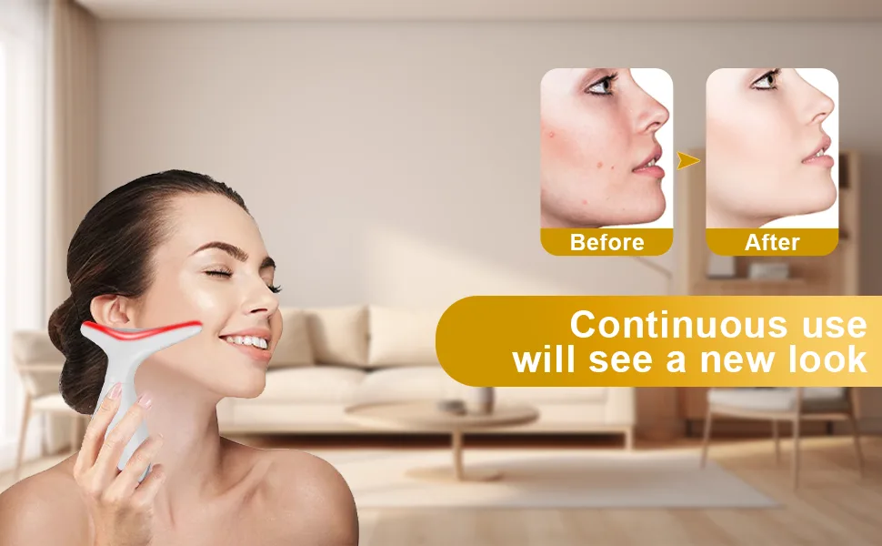 Facial-Massager 4 Color Face Device(4 Modes White) - tool
