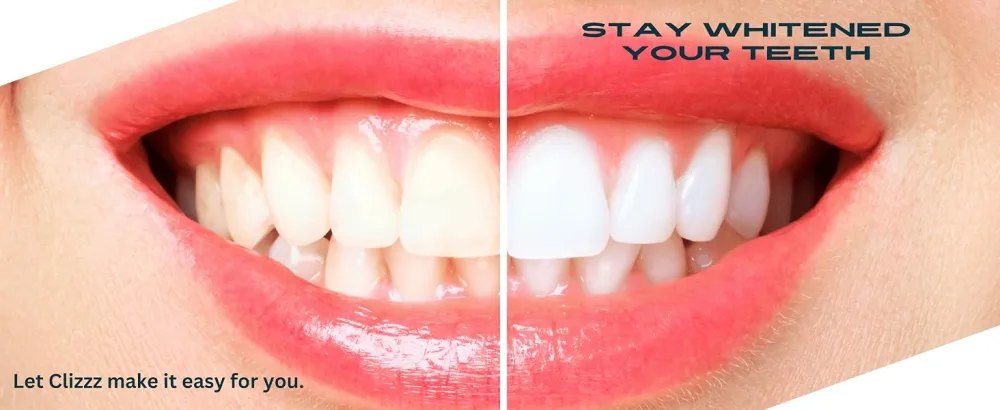 Teeth Whitening Strips for Sensitive Teeth - 30 Strips Enamel Safe SGS LAB Certified Technology for Whiter Teeth 30 Minutes Fast Results Non-Sensitive 15 Treatments Mint - product information 7