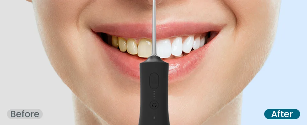 Water Flosser - Cordless Portable Oral Irrigator with 2000mAh Battery 4 Nozzle Types 4 Cleaning Modes 265ml Water Tank IPX7 Waterproof - water flosser