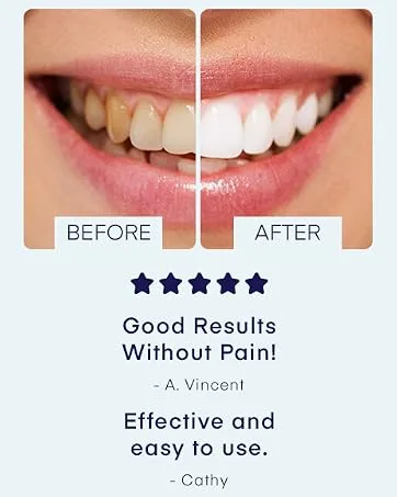 Purple Color Corrector Teeth Whitening Foam for Teeth Whitening - Purple Teeth Whitening Foam for a Brighter Smile - teeth whitening 3
