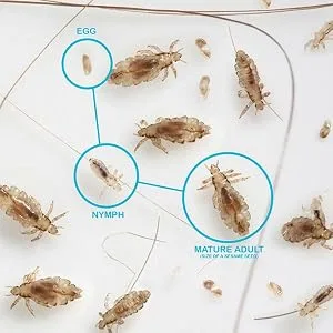 NitWits All-in-One Head Lice Treatment Spray Kills Nits & Eggs Includes Lice Spray 120ml & Nit Comb NitWits All In One Spray - head lice;lice;