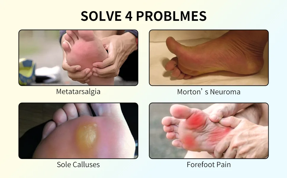 Metatarsal Pads Unisex - Reduce Foot Pain Support Shoes - shoe insert