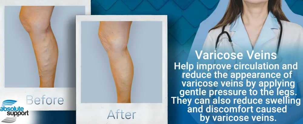 ABSOLUTE SUPPORT Hi Thigh Compression Stockings 20-30 mmHg for Women and Men with Closed Toe - Over the Knee Compression Hose for Varicose Veins Circulation Black Small Medium Black - Unisex Compression Stockings