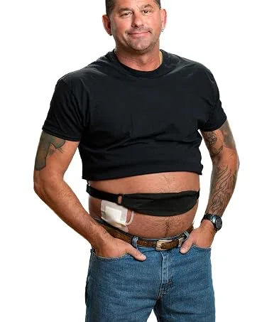 PD Showermate- Catheter Showering Support - Tuck-away PD dialysis belt