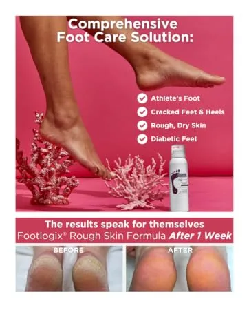 FOOTLOGIX Massage Formula Lotion 8.45 oz - product information 8