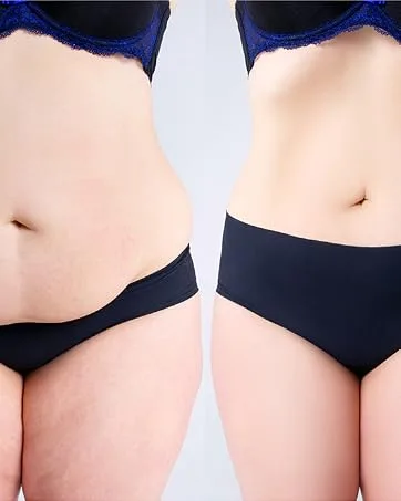 NS28 Program - Lose up to 28 pounds in 28 Days. - Before After Weight Loss