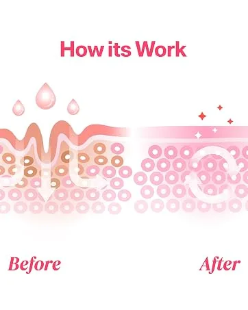 Ice Roller For Face Fresh up Ice Cube Roller Massager For Face Reduce puffiness and dark circles Minimize pores and improve Skin texture (Pink Ice Roller) - How Its Work Ice Roller for Face , Face ice roller , ice roller , ice cube roller