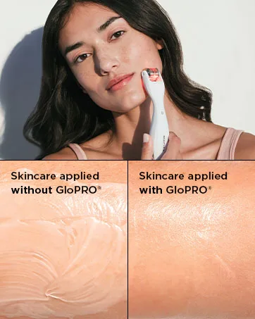 BeautyBio GloPRO Tool & 4 MicroTip Attachment Heads (Face Eye Lip Body) - glopro beautybio skincare routine microneedling tool microdermabrasion derma roller