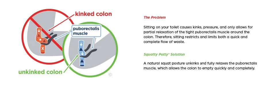 Squatty Potty The Original Bathroom Toilet Stool, 7 Inch height, White - kinkedunkinked