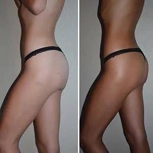 Spray Tan Solution - SJOLIE No. 12 - DARK Blend (8oz) 8 Fl Oz (Pack of 1) - no12 before after